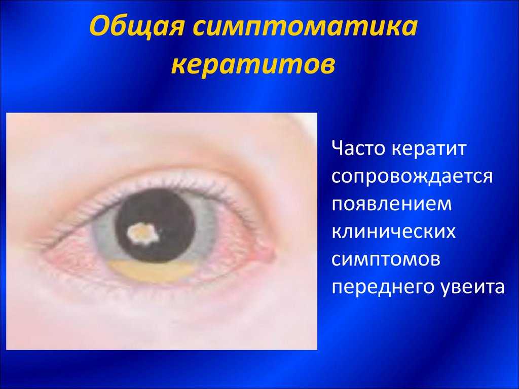 Белая пленка на глазах у кошки: причины появления, что делать, как лечить в домашних условиях