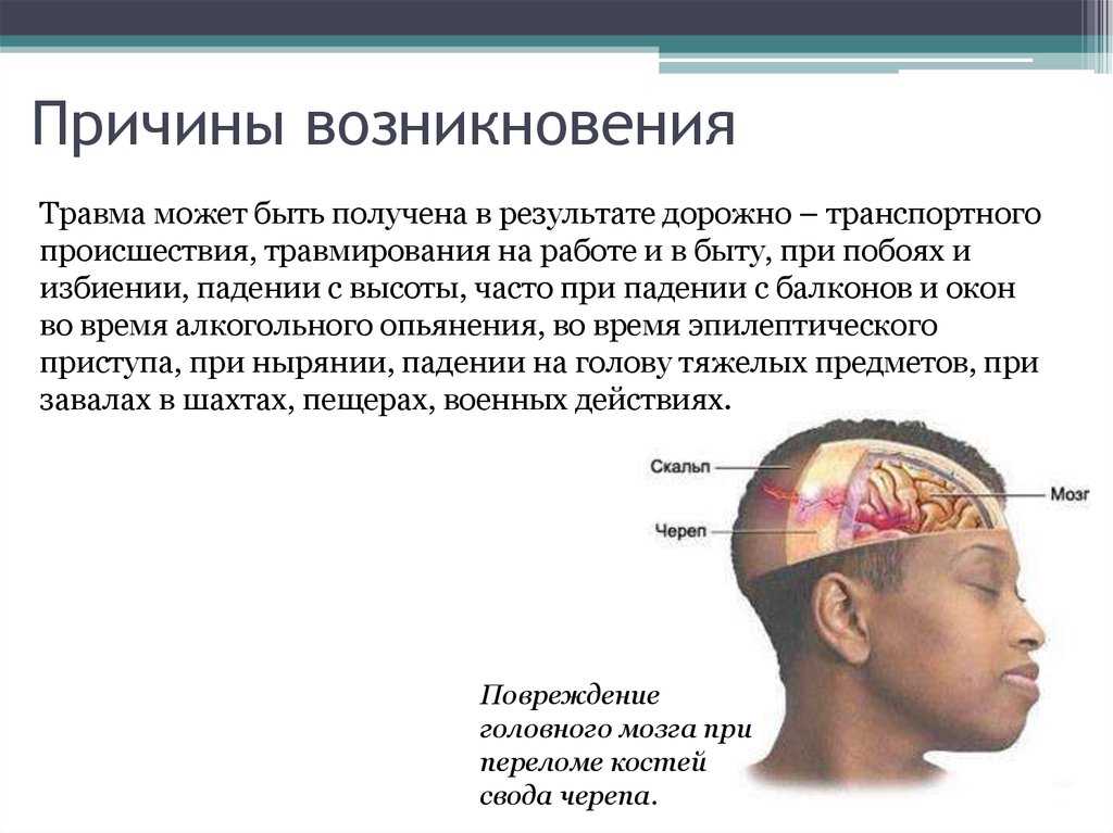 Причины появления верхнего. Причины возникновения травм головного мозга.. Причины возникновения ушиба головного мозга. Ушиб головного мозга причины.