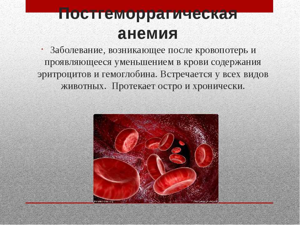 Сердечная анемия